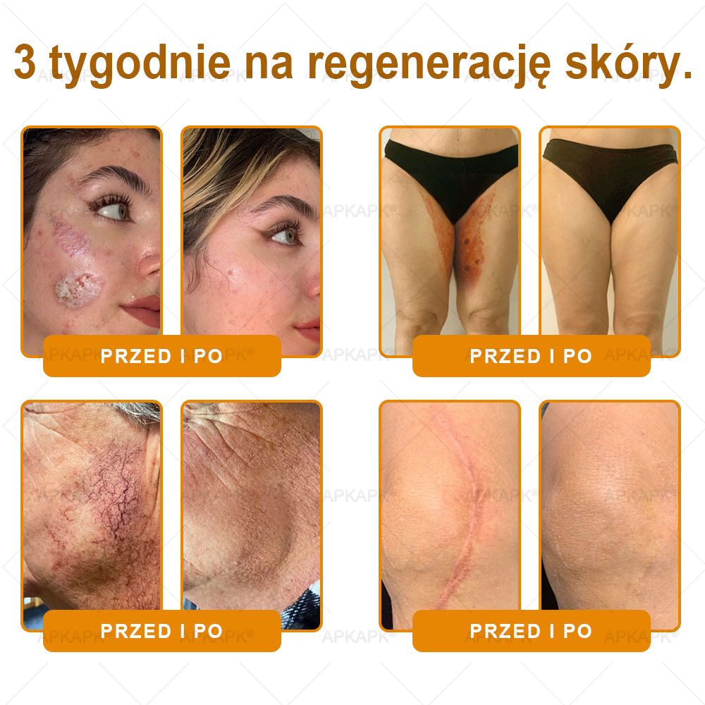 🎁 🎁Zostało tylko 5 sztuk! Oferujemy dodatkową zniżkę 50%! Zdobądź formę i zdrowie. Nie czekaj, stracisz okazję, aż do przyszłego roku