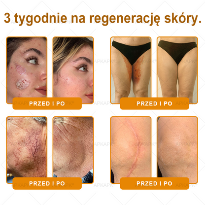 🎁 🎁Zostało tylko 5 sztuk! Oferujemy dodatkową zniżkę 50%! Zdobądź formę i zdrowie. Nie czekaj, stracisz okazję, aż do przyszłego roku