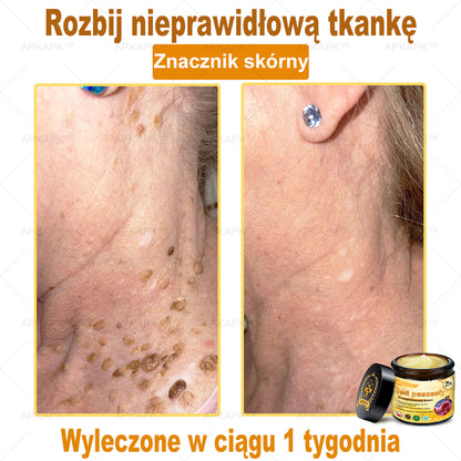 ΑPΚΑPK™ Jad Pszczoły Kompleksowy Krem🥇🥇🥇pomaga w leczeniu problemów skórnych, takich jak: zmarszczki, blizny, plamy pigmentacyjne, rozstępy, trądzik, łuszczyca, egzema, zmiany skórne, podrażnienia, stany zapalne i inne problemy skórne🔥