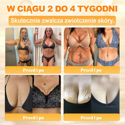 🎁 🎁Zostało tylko 5 sztuk! Oferujemy dodatkową zniżkę 50%! Zdobądź formę i zdrowie. Nie czekaj, stracisz okazję, aż do przyszłego roku