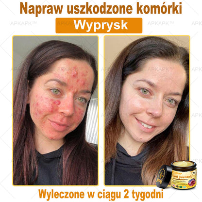 ΑPΚΑPK™ Jad Pszczoły Kompleksowy Krem🥇🥇🥇pomaga w leczeniu problemów skórnych, takich jak: zmarszczki, blizny, plamy pigmentacyjne, rozstępy, trądzik, łuszczyca, egzema, zmiany skórne, podrażnienia, stany zapalne i inne problemy skórne🔥