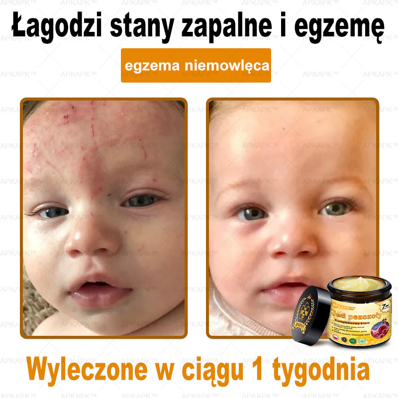 ΑPΚΑPK™ Jad Pszczoły Kompleksowy Krem🥇🥇🥇pomaga w leczeniu problemów skórnych, takich jak: zmarszczki, blizny, plamy pigmentacyjne, rozstępy, trądzik, łuszczyca, egzema, zmiany skórne, podrażnienia, stany zapalne i inne problemy skórne🔥