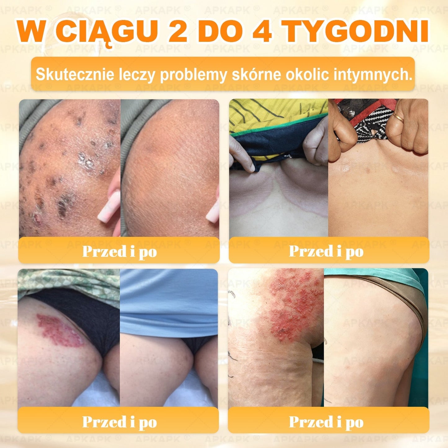 🎁 🎁Zostało tylko 5 sztuk! Oferujemy dodatkową zniżkę 50%! Zdobądź formę i zdrowie. Nie czekaj, stracisz okazję, aż do przyszłego roku