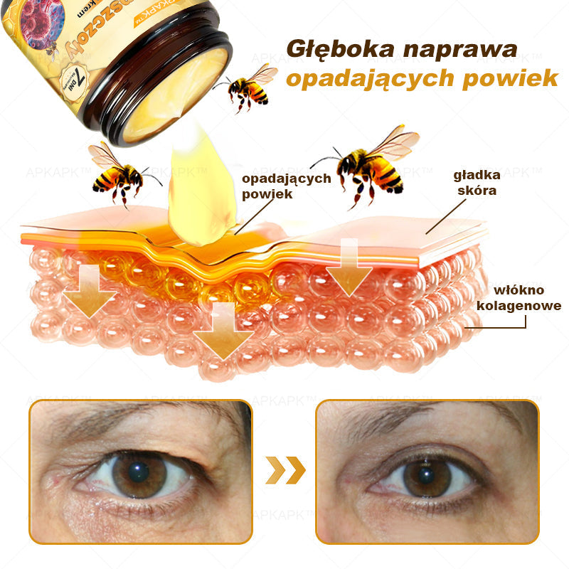 ΑPΚΑPK™ Jad Pszczoły Kompleksowy Krem🥇🥇🥇pomaga w leczeniu problemów skórnych, takich jak: zmarszczki, blizny, plamy pigmentacyjne, rozstępy, trądzik, łuszczyca, egzema, zmiany skórne, podrażnienia, stany zapalne i inne problemy skórne🔥