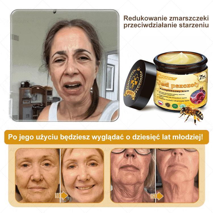 ΑPΚΑPK™ Jad Pszczoły Kompleksowy Krem🥇🥇🥇pomaga w leczeniu problemów skórnych, takich jak: zmarszczki, blizny, plamy pigmentacyjne, rozstępy, trądzik, łuszczyca, egzema, zmiany skórne, podrażnienia, stany zapalne i inne problemy skórne🔥