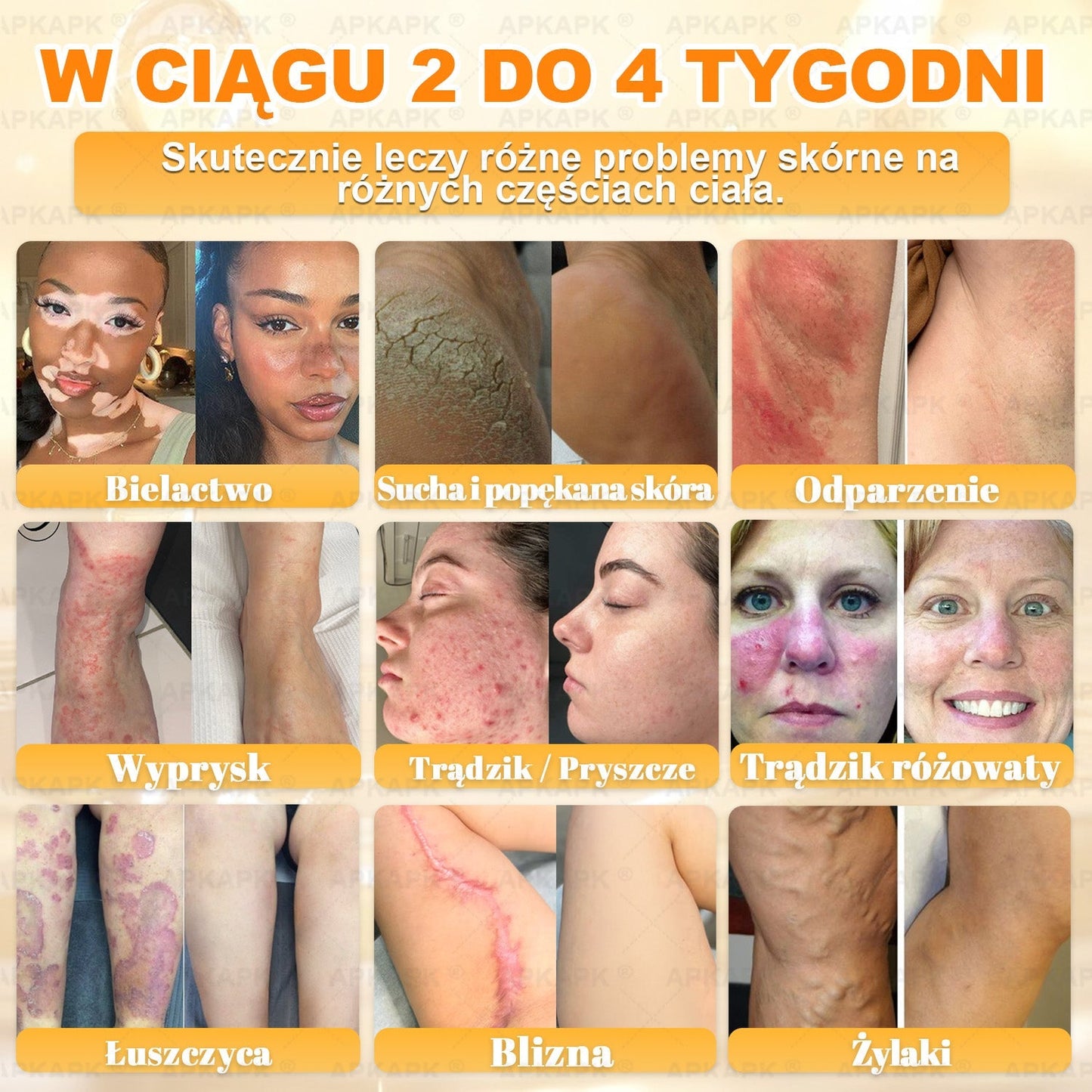 🎁 🎁Zostało tylko 5 sztuk! Oferujemy dodatkową zniżkę 50%! Zdobądź formę i zdrowie. Nie czekaj, stracisz okazję, aż do przyszłego roku