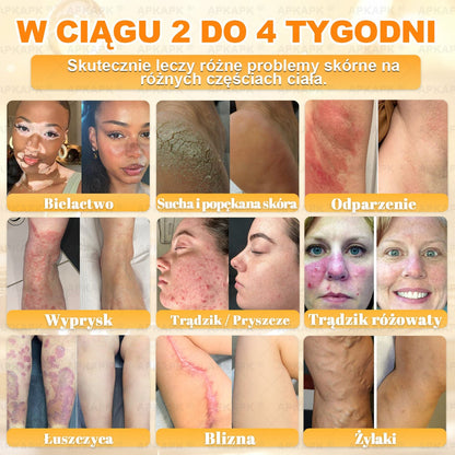 🎁 🎁Zostało tylko 5 sztuk! Oferujemy dodatkową zniżkę 50%! Zdobądź formę i zdrowie. Nie czekaj, stracisz okazję, aż do przyszłego roku