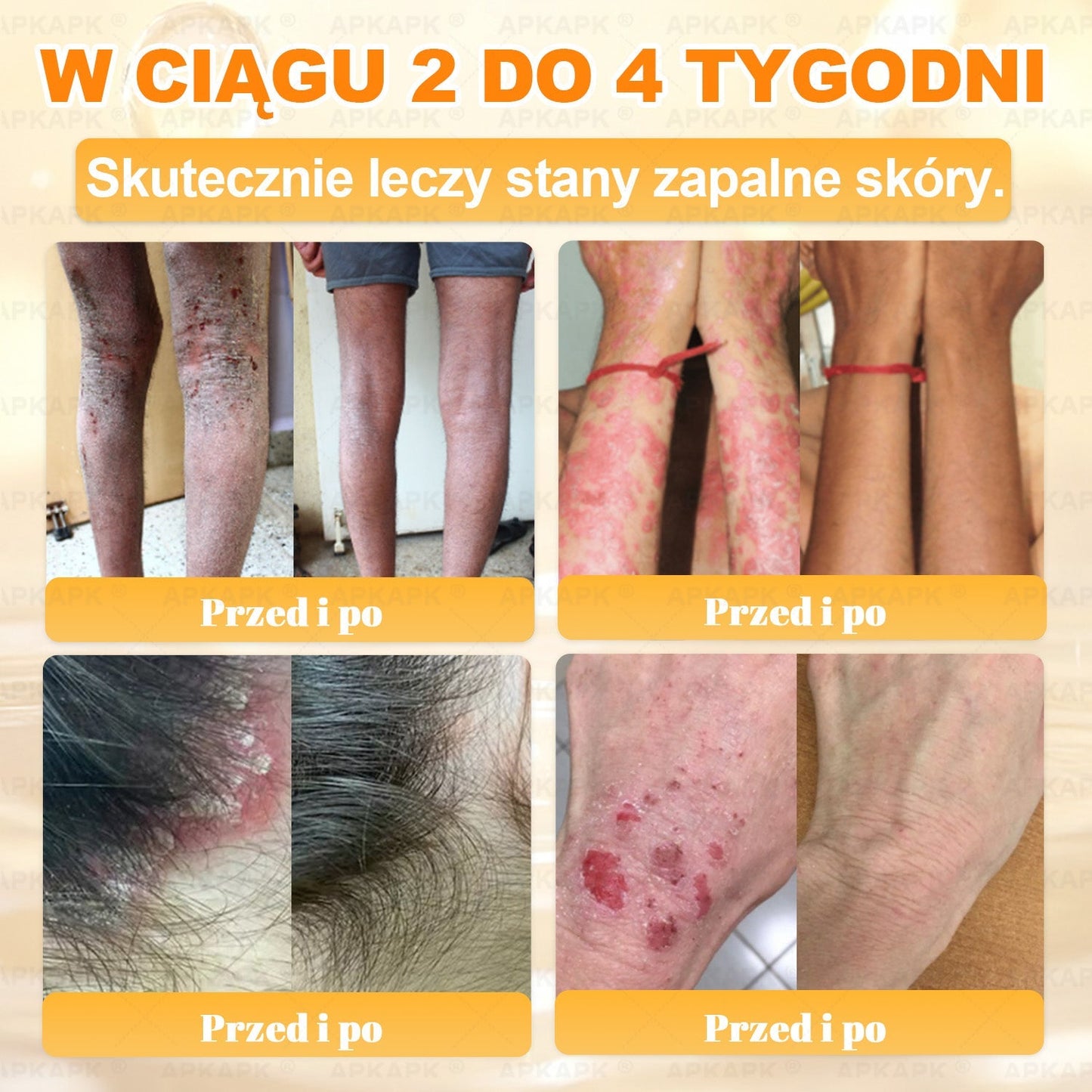 🎁 🎁Zostało tylko 5 sztuk! Oferujemy dodatkową zniżkę 50%! Zdobądź formę i zdrowie. Nie czekaj, stracisz okazję, aż do przyszłego roku