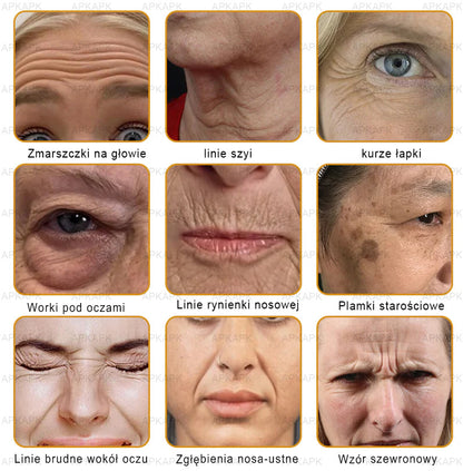 ΑPΚΑPK™ Jad Pszczoły Kompleksowy Krem🥇🥇🥇pomaga w leczeniu problemów skórnych, takich jak: zmarszczki, blizny, plamy pigmentacyjne, rozstępy, trądzik, łuszczyca, egzema, zmiany skórne, podrażnienia, stany zapalne i inne problemy skórne🔥